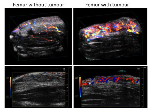 Doppler images showing increased vasculature and blood flow in the presence of an osteosarcoma which contributes to an increase in tumour cell proliferation, invasion and metastasis.