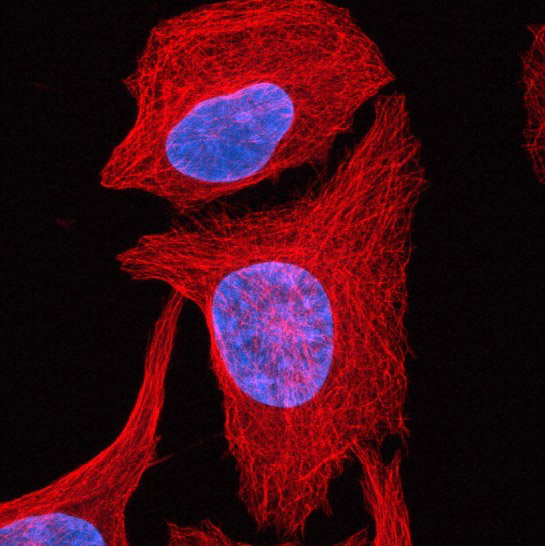 Human Osteosarcoma Cells 