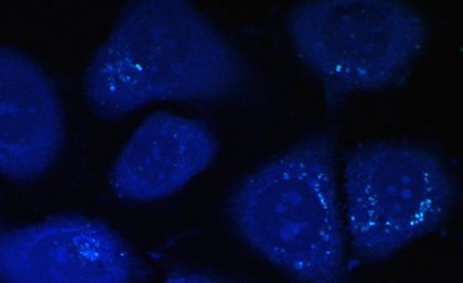 Cholesterol in cells