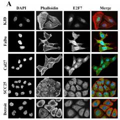 New treatment to reverse drug resistance in some cancers