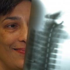 Trials bring hope for world-first rheumatoid arthritis treatment