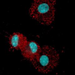 New insight into how the skin evades the immune system