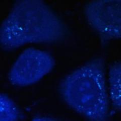 Cholesterol in cells