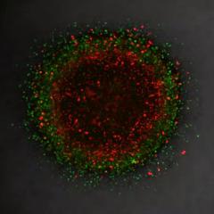 3D melanoma model helps explain therapy evasion
