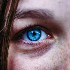 Blue eye and freckled face