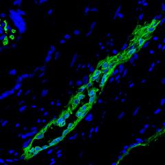 Two in one: human placenta stem cells hold a dual benefit