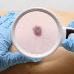 Will melanoma research be hindered by social distancing?